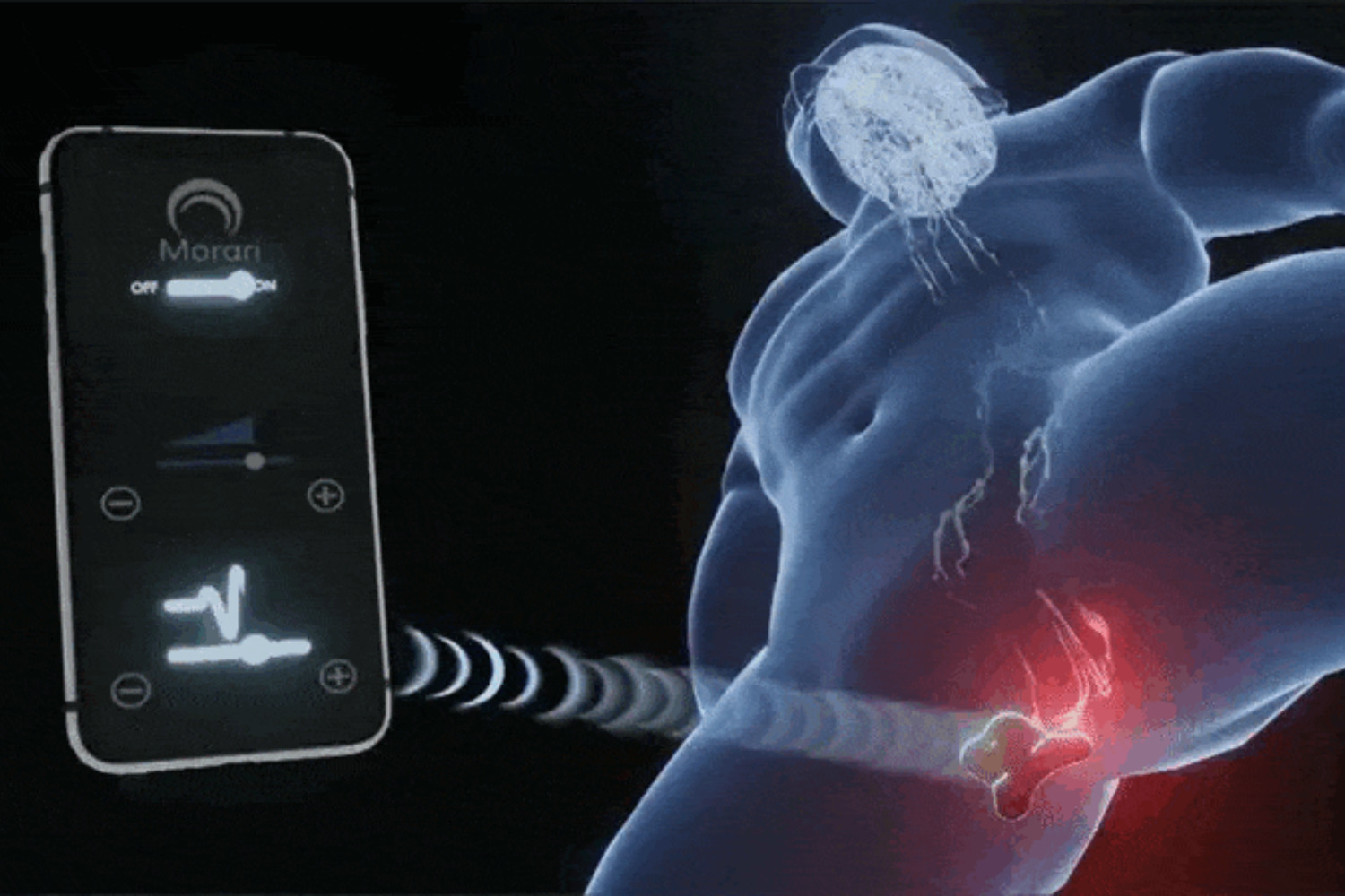 Lanzan un “rumble pack” de 300 dólares para el perineo. El dispositivo Mor promete retrasar o intensificar la eyaculación mediante impulsos eléctricos